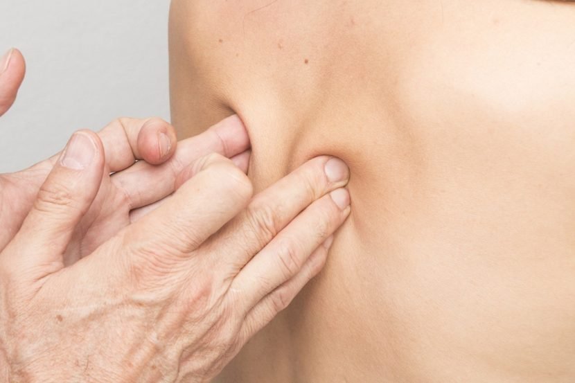 low back pain