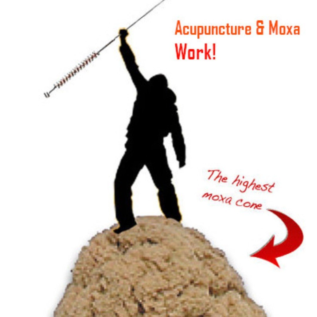 Moxibustion is the technique of stimulating acupuncture points with burning Chinese mugwart. The main purpose is to warm up the system, improve functioning and promote energy flow. It is often used for yang (warm) and qi (vitality) deficiency.
#moxibustion, #moxa, #moxa therapy, #breech baby#acupunctureOttawa #TCMOttawa #tcmworksOttawa #acupuncture #tuinaOttawa #herbalmedicineOttawa #moxibustionOttawa #cuppingOttawa #acupuncture #TCM #traditionalChineseMedicine #fatigueOttawa #fertilityOttawa #painOttawa #menopauseOttawa #stressdepressionanxiety #WeiYuan #yin-yang #taichi